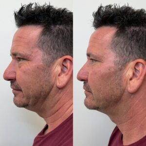 00D7CD95-C518-4028-B625-2E1A903E2285