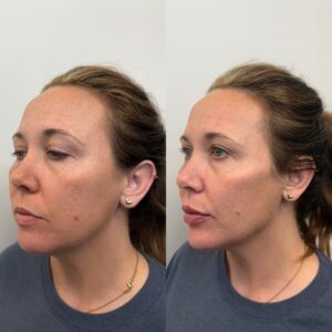 57FEE5ED-6C06-4B0C-B168-41BD071912CC