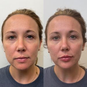 6ED110E2-8856-4615-A2B5-4CC2C7A815F6