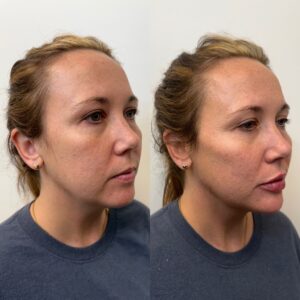 961B60B0-F61F-4B76-BA32-DD829B22D8A8